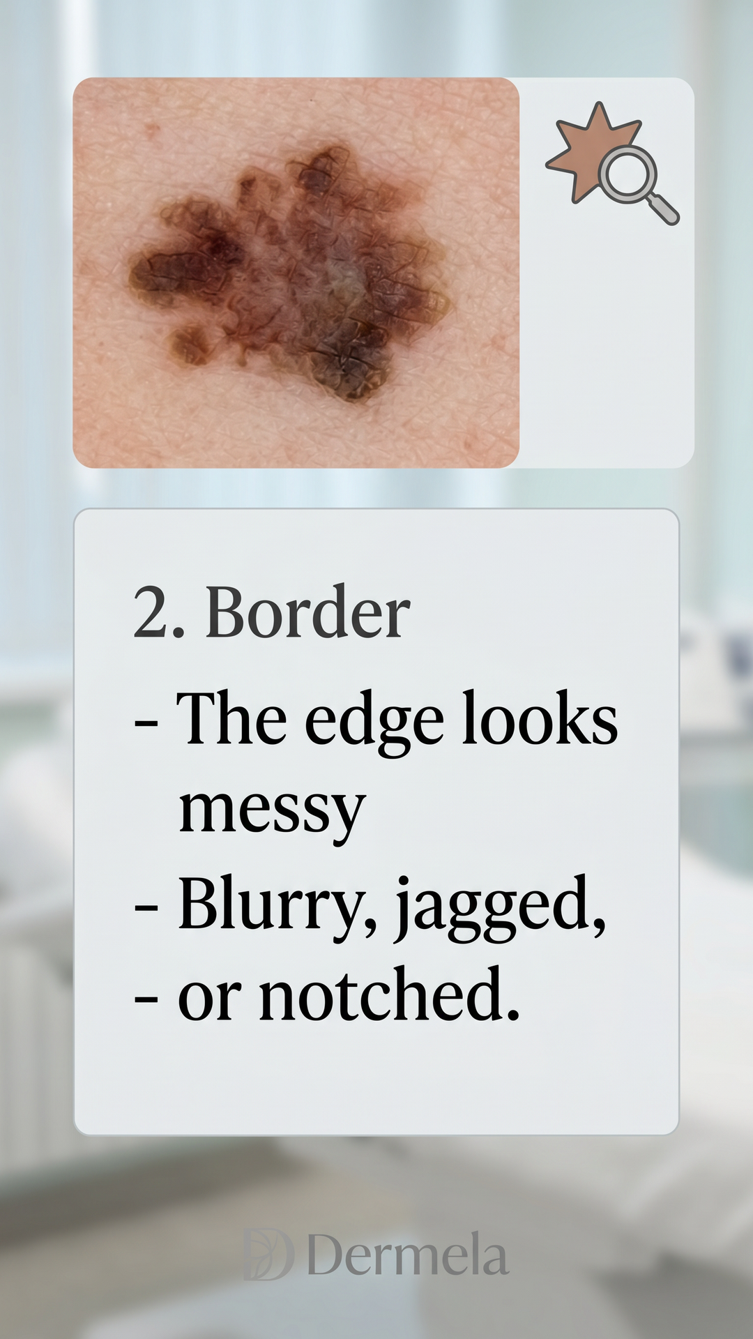 Illustrated timeline showing what to track for how to track a mole over time.