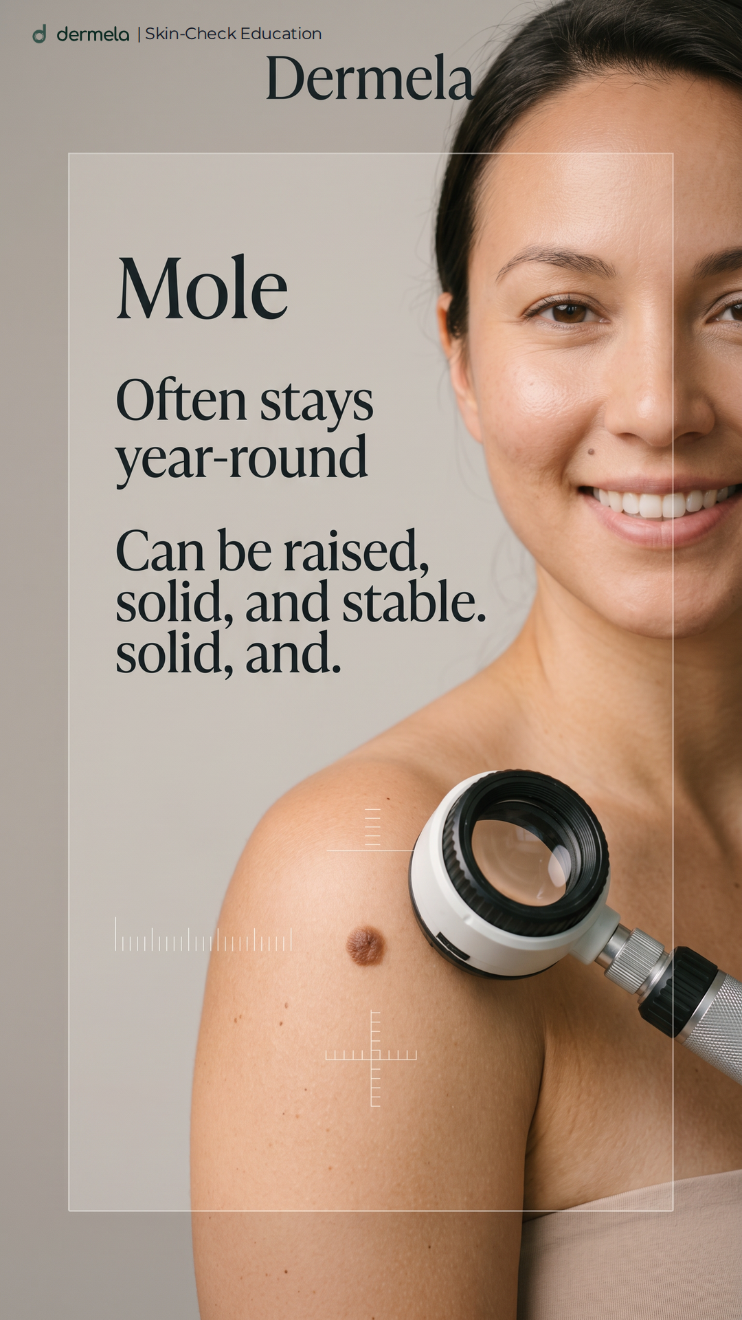 Illustrated timeline showing what to track for mole vs freckle.